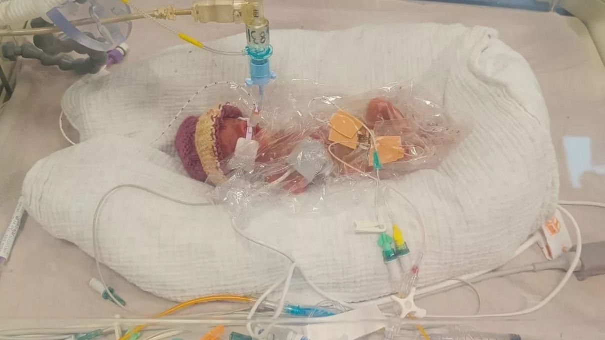 Робин родилась настоящей крохой Робин родилась настоящей крохой