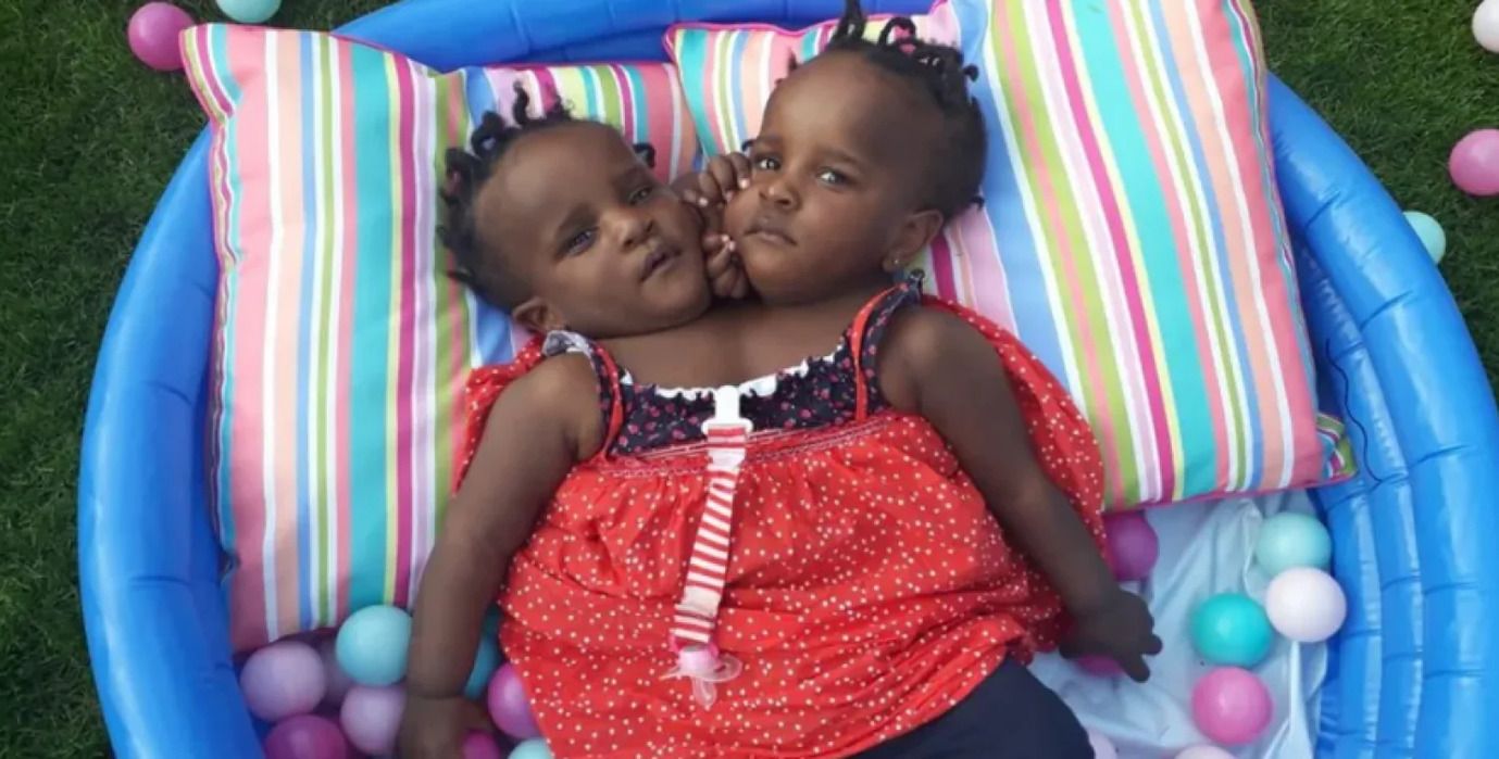 Мариеме и Ндейе выжили несмотря на прогнозы врачей Мариеме и Ндейе выжили несмотря на прогнозы врачей